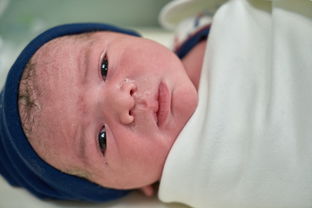 孕期妊娠合并新生儿GSDII型怎么酶替代？